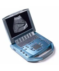 Auxo Medical - Sonosite Micromaxx - AM-SONOMMAXX - Refurbished Ultrasound System Sonosite Micromaxx 128 Channels, Up To 165 Db Dynamic Range, 256 Shades Grey Scale