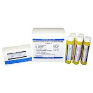 Diazyme Laboratories - DZ568B-BY2 - Reagent Kit Cardiac / General Chemistry Homocysteine For Beckman AU Analyzers 375 Tests R1: 2 X 52 mL  R2: 2 X 15 mL