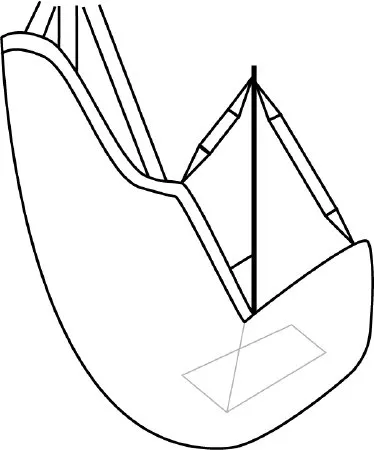 Joerns - 110-D - Sling  Comfort Seat  Head Support  Dacron  Straps & Wire