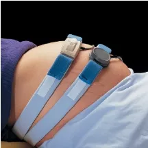 Deroyal - M1140 - Fetal Monitor Strap Abdominal  Elastic  with Button Tab