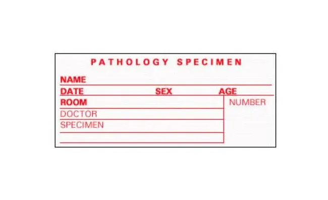 Precision Dynamics - Timemed - SP-5 - Pre-printed Label Timemed Laboratory Use White Pathology Specimen, Name, Date, Sex, Age, Room, Doctor, Speciment, Number Red Lab / Specimen 2 X 3-1/2 Inch